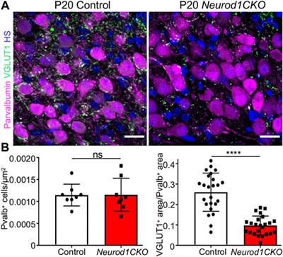 Early Deletion of Neurod1 Alters Neuronal Lineage Potential and Diminishes Neurogenesis in the Inner Ear